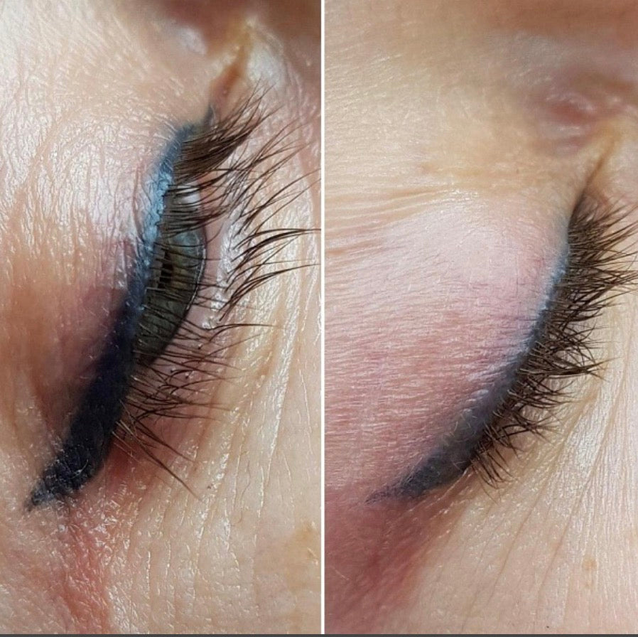 ALKALINE REMOVER (pH 12,6) – SET SPECIAL BOX